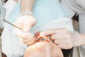 : A dental professional examines and repairs a patient’s chipped tooth during an emergency visit. Modern techniques 