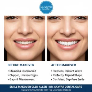 Smile Makeovers in Glen Allen: Top Cosmetic Dentistry Options for a Confident Smile